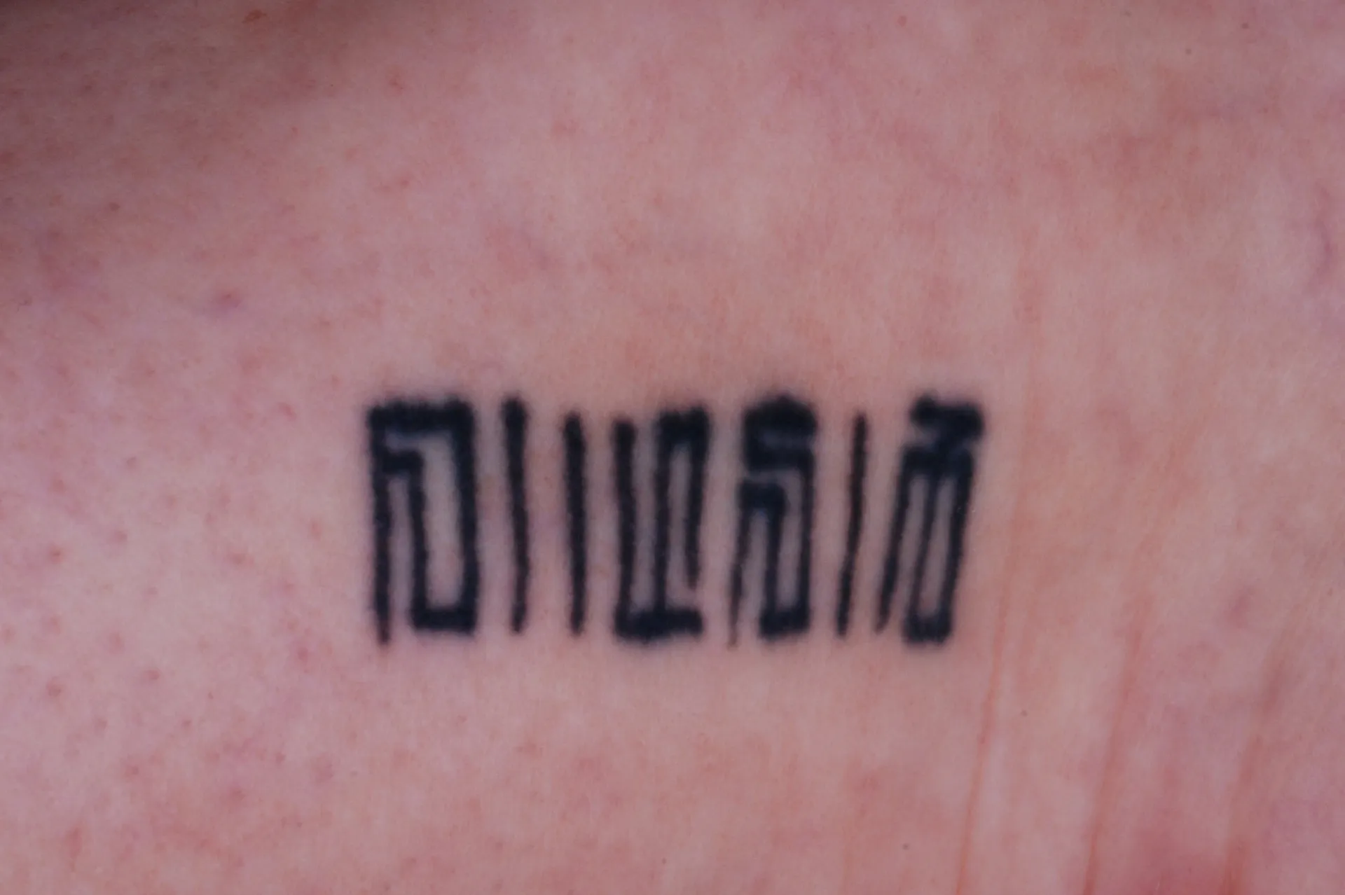 Barcode Text — tattoo before laser removal treatment