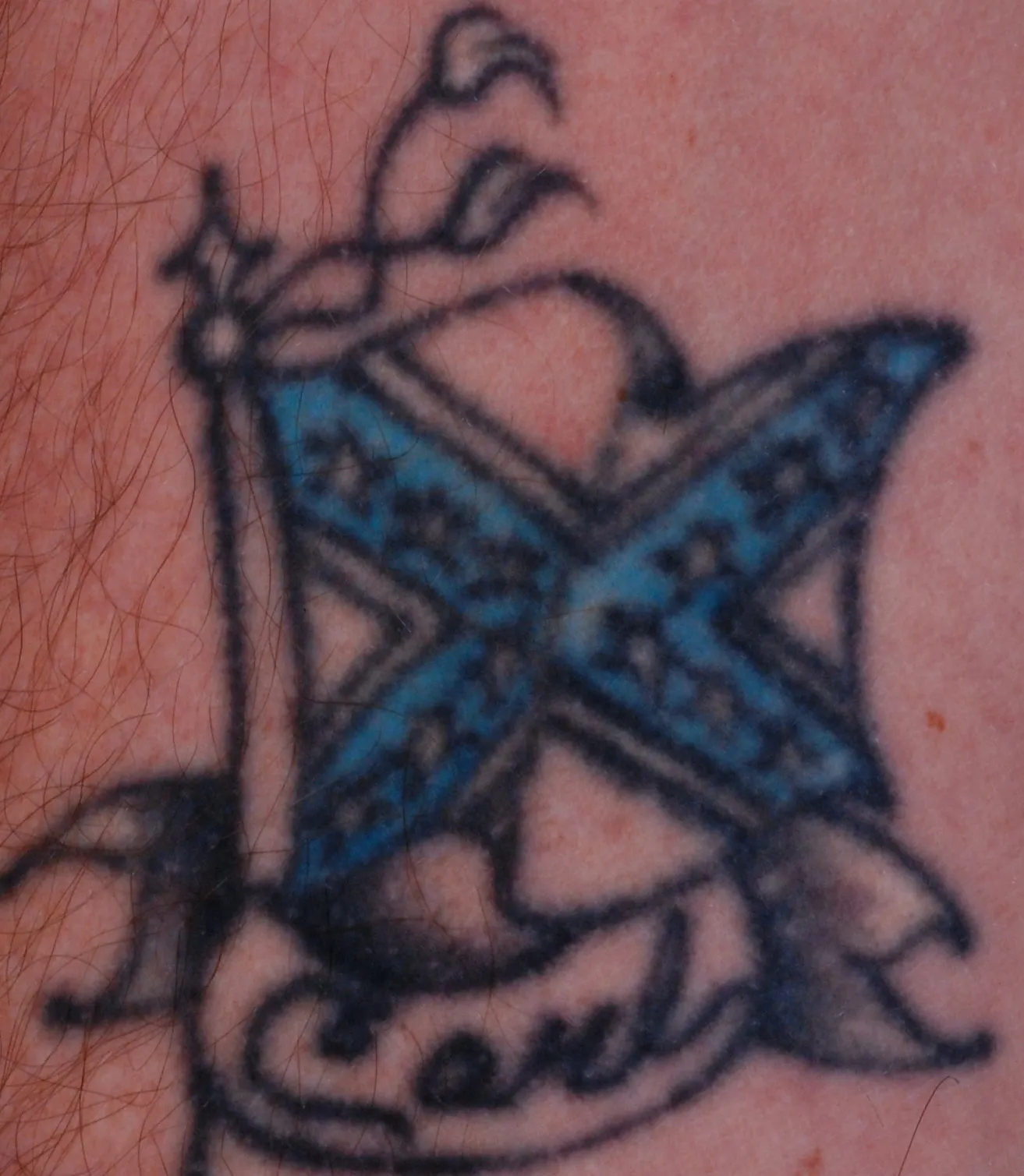 Blue Star Cross — tattoo before laser removal treatment