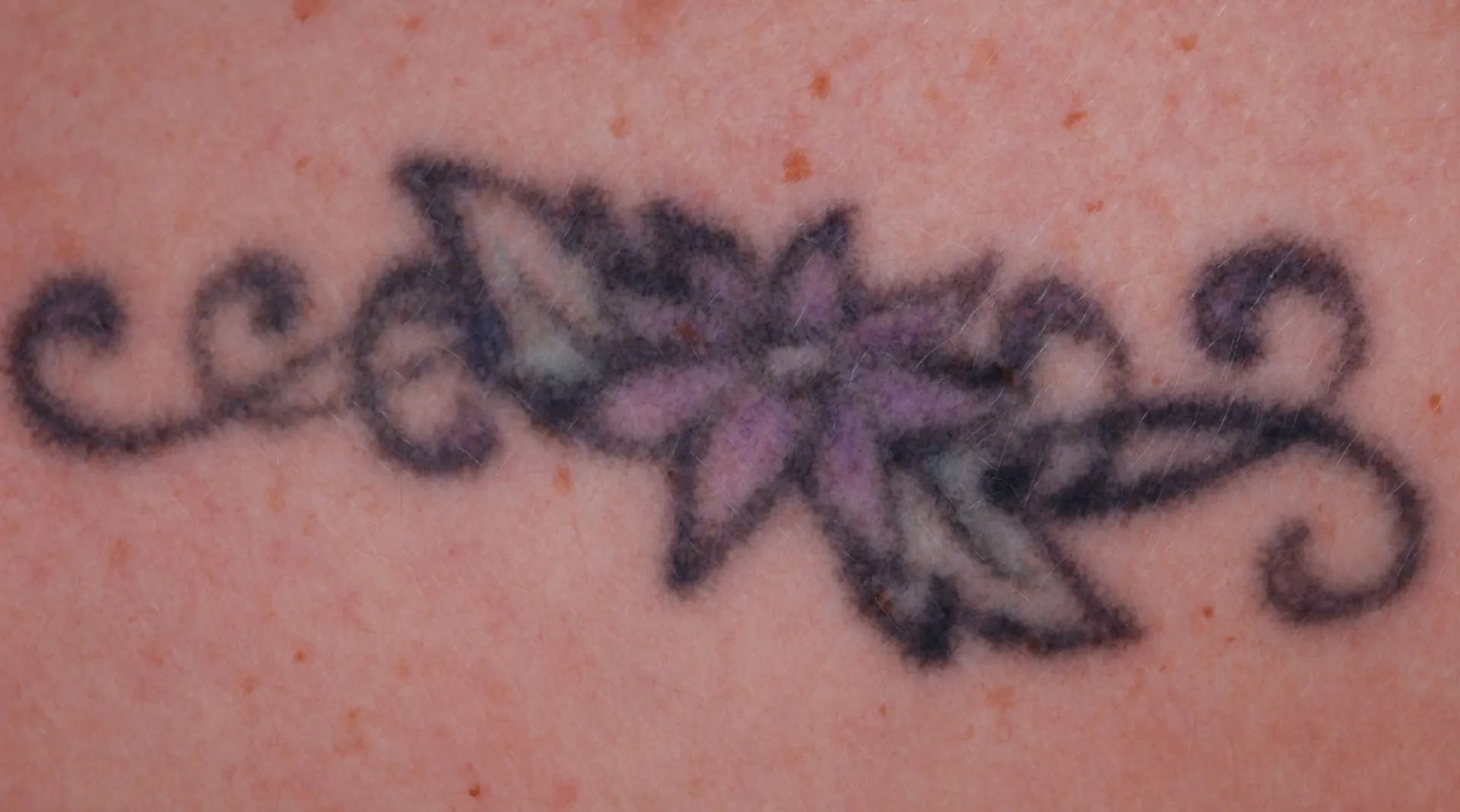 Floral Design — tattoo before laser removal treatment