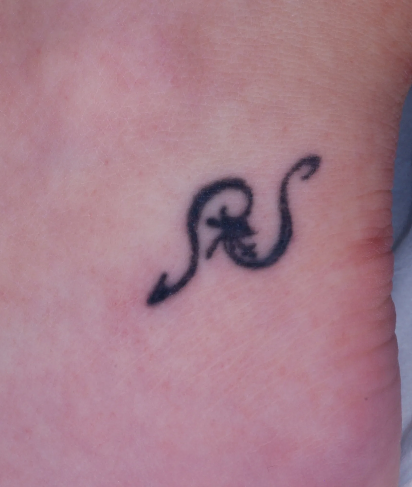 Decorative Symbol — tattoo before laser removal treatment