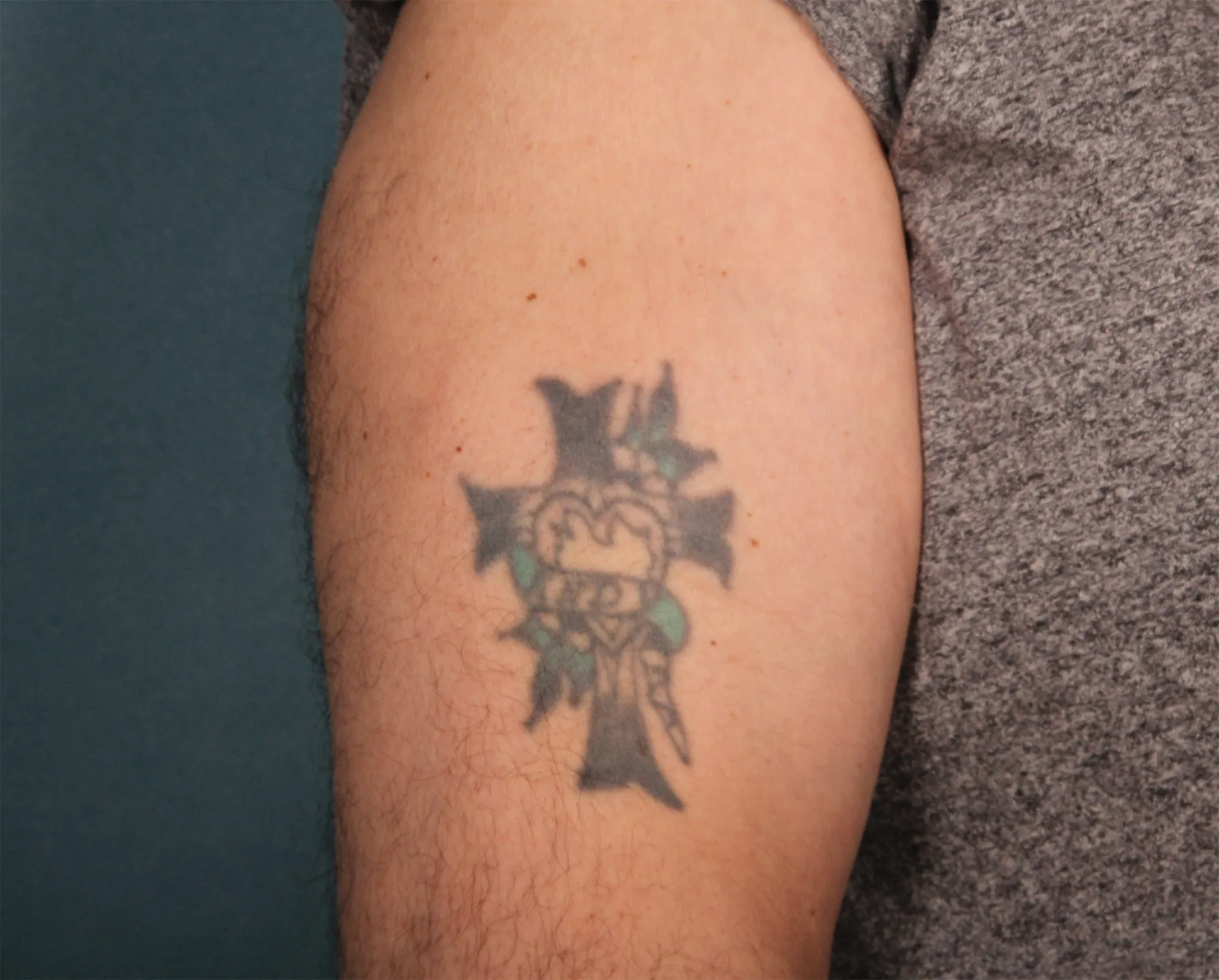Cross with Heart — tattoo before laser removal treatment