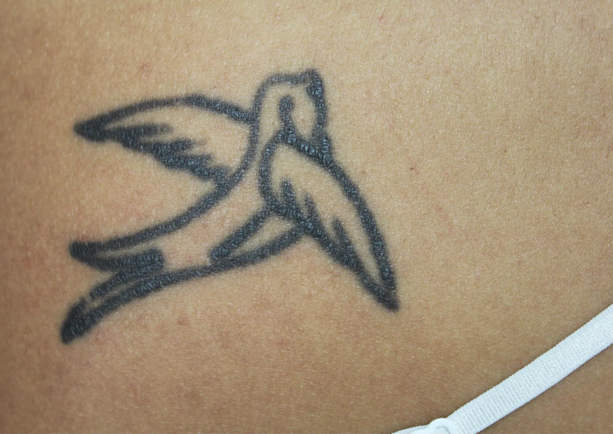 Tribal Design — tattoo before laser removal treatment